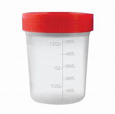 Urine Container 1's - Hospitech and Pharma Limited
